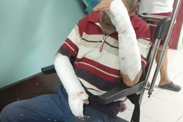KÖPEKLERİN SALDIRISINA UĞRAYAN BİR KİŞİ FECİ ŞEKİLDE YARALANDI